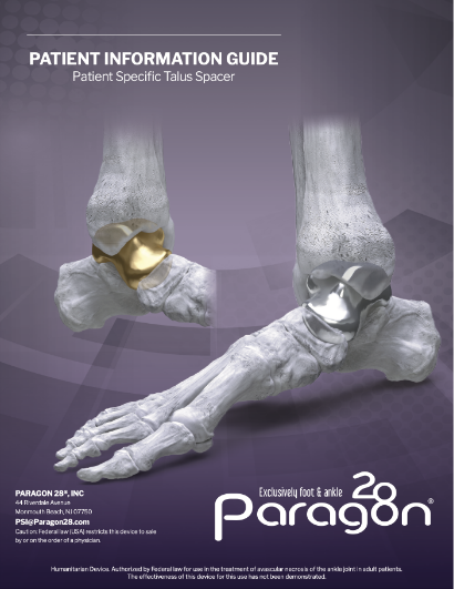 File Download of Patient Information Guide – Paragon 28® Patient Specific Talus Spacer
