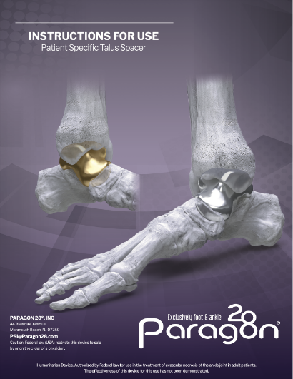 File Download of INSTRUCTIONS FOR USE Patient Specific Talus Spacer