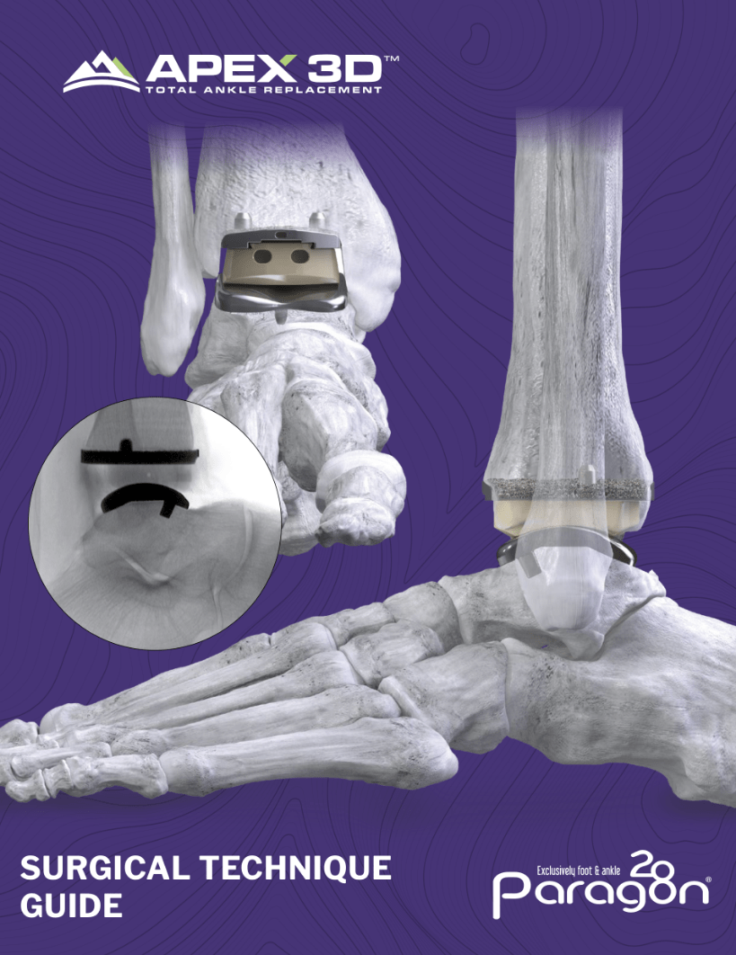 File Download of APEX 3D™ Total Ankle Replacement System Surgical Technique Guide