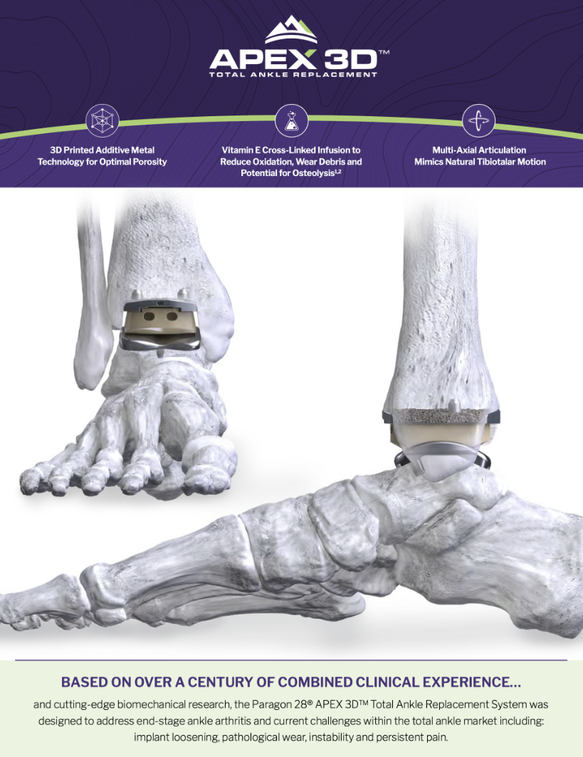 File Download of APEX 3D™ Ankle Replacement System Brochure