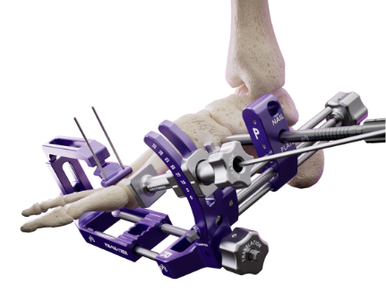 Introducing the  SMART Bun-Yo-Matic™