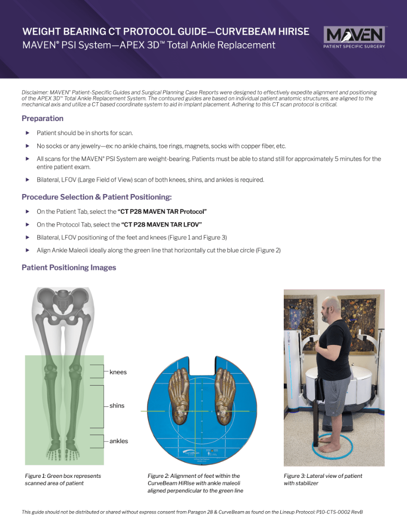 File Download of Weight-Bearing CT Scanning Protocol – CurveBeam HiRise